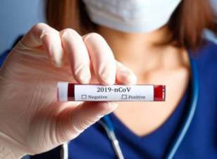 COVID-19-ի հետեւանքները չեզոքացնելու միջոցառումների շրջանակներում Արցախում 391,2 մլն դրամի օգնություն է ցուցաբերվել