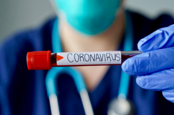 Մեկ օրում հաստատվել է կորոնավիրուսի 706 նոր դեպք