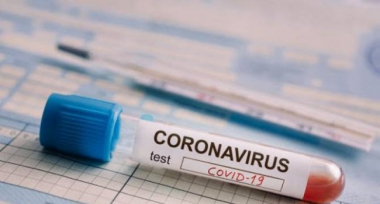 Գիտնականները հայտնաբերել են COVID-19-ի 6 տարբեր տեսակներ