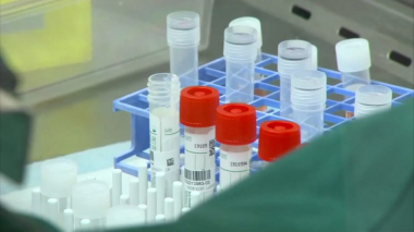 Կորոնավիրուսի հետևանքով  կա մահվան 8 նոր դեպք