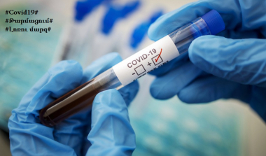 COVID_19 քրոնիկա. Հայաստանում վիրուսը նահանջում է. տեսանյութ