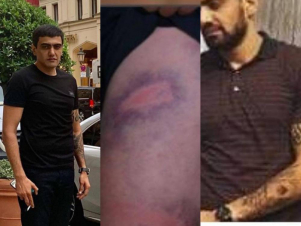 Գորիսի քաղաքապետը ծեծի է ենթարկել 30-ամյա երիտասարդին՝ վազանց կատարելու համար