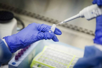 Եվրամիությունում առաջարկել են COVID-19-ի թեստավորման ընդհանուր համակարգ սահմանել