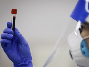 Ավստրալիայում հինգ ամսվա ընթացքում առաջին անգամ կորոնավիրուսով վարակման նոր դեպք չի գրանցվել