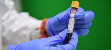 Հայտնաբերվել է կորոնավիրուսի առաջին մուտացիան, որի դեմ հակամարմիններն անզոր են