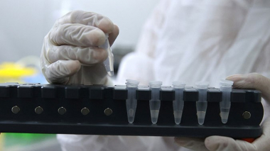 ԱՄՆ-ում կորոնավիրուսից մահացածների թիվը գերազանցել է Երկրորդ համաշխարհային պատերազմում ունեցած զոհերի թիվը