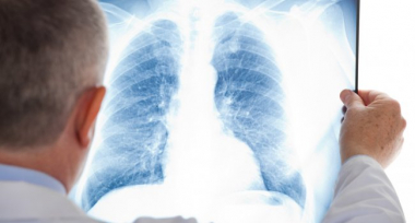 Ինչո՞վ է վտանգավոր կորոնավիրուսային թոքաբորբը