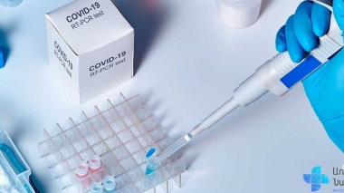 Հաստատվել է կորոնավիրուսային հիվանդության 198 նոր դեպք, առողջացել է 276 մարդ