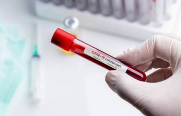 Հաստատվել է կորոնավիրուսային հիվանդության 58 նոր դեպք. գրանցվել է 8 մահ