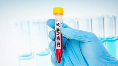 Հայաստանում հաստատվել է կորոնավիրուսի 154 նոր դեպք, առողջացել է 168 քաղաքացի