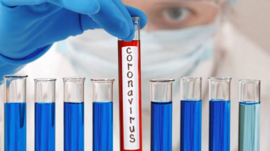 Արցախում հայտնաբերվել է կորոնավիրուսային հիվանդության 4 նոր դեպք