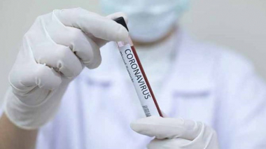 Լեհաստանը կորոնավիրուսի թեստի արդյունքները կպահանջի երկիր մուտք գործելիս