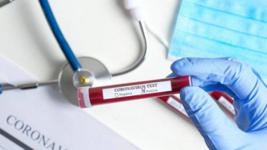 Արցախում հաստատվել է կորոնավիրուսի 7 նոր դեպք