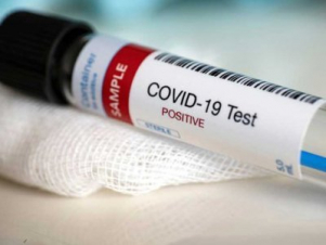 Արցախում հաստատվել է կորոնավիրուսային հիվանդության 4 նոր դեպք