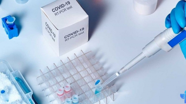 Հայաստանում հաստատվել է կորոնավիրուսի 726 նոր դեպք, մահացել է 22 մարդ