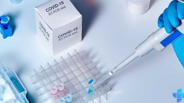 Հայաստանում հաստատվել է կորոնավիրուսի 298 նոր դեպք, մահացել է 17 մարդ