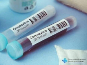 Հայաստանում հաստատվել է կորոնավիրուսով վարակվելու 131 նոր դեպք