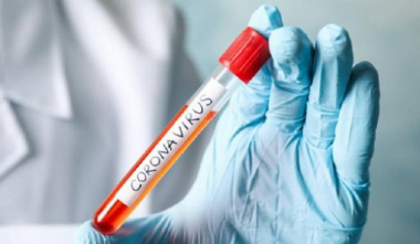 Արցախում հաստատվել է կորոնավիրուսի 2 նոր դեպք