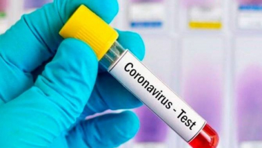 Արցախում երկրորդ օրն անընդմեջ կորոնավիրուսի նոր դեպքեր չեն հայտնաբերվել