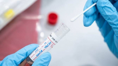 Արցախում հաստատվել է կորոնավիրուսային հիվանդության 2 նոր դեպք