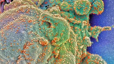 Կորոնավիրուսի «Դելտա+» շտամ է հայտնաբերվել 10 երկրում