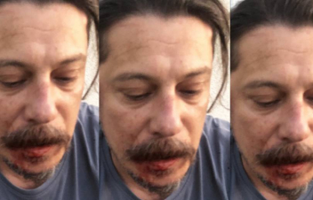 Բեռլինում հարձակվել են գերմանաբնակ թուրք ընդդիմադիր լրագրողի վրա