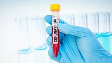 Արցախում կորոնավիրուսային հիվանդության նոր դեպքեր չեն հաստատվել