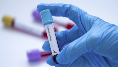 Հայաստանում վարակման 112 նոր դեպք է հաստատվել