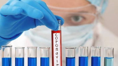 Ռուսաստանում կորոնավիրուսով 22 010 վարակվածներ են հայտնաբերել մեկ օրում. դա նվազագույնն Է հունիսի 30-ից ի վեր