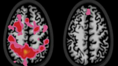 Հարցնում եք, ինչպե՞ս կարող է խմիչքը ազդել դեռահասների վրա