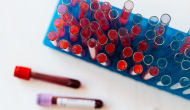 Արցախում ևս մեկ մահ է գրանցվել կորոնավիրուսից, հաստատվել է 13 նոր դեպք