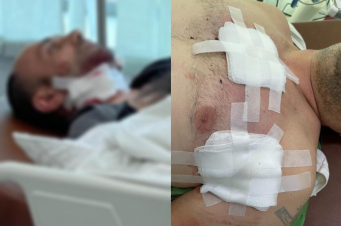 Արցախի ՄԻՊ-ը նոր մանրամասներ է հայտնել Շուշիի մոտ տեղի ունեցած դեպքի վերաբերյալ