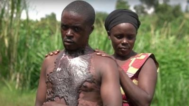 Ծնողները այրել են որդուն, երբ իմացել են, որ ուրիշի հետ է ամուսնացել