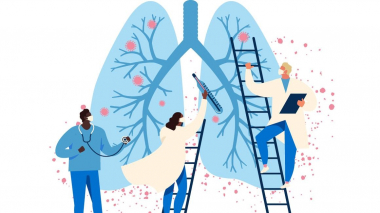 Արցախում կորոնավիրուսային հիվանդության 62 նոր դեպք է գրանցվել