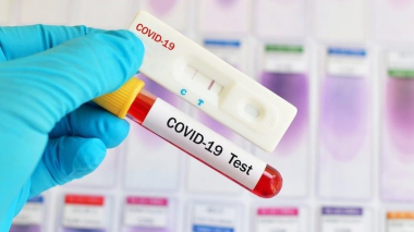 Արցախում կորոնավիրուսով վարակվելու 14 նոր դեպք է գրանցվել