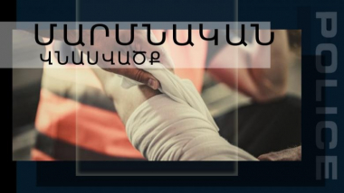 Պատանիների վեճն ավարտվել էր դանակահարությամբ. Սիսիանի ոստիկանների բացահայտումը