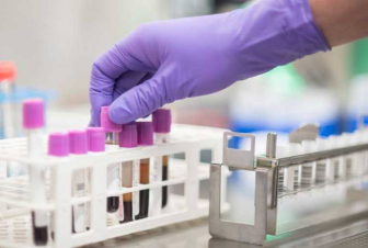 Կապկի ծաղիկի գրանցված դեպքերի թիվը 80 է. ԱՀԿ