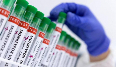 Վրաստանում «Կապիկի ծաղիկ» վիրուսի առաջին դեպքն է գրանցվել