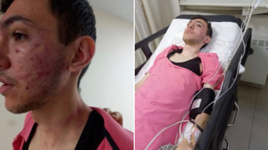 Թուրքիայում հայ երիտասարդի են ծեծել.ըստ Փալյանի միջադեպը ռասիստական բլույթ է կրել