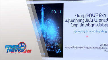 Միասին հաղթահարենք թոքի քաղցկեղը