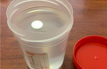 Բուժակը փորձել է դատապարտյալին բժշկական սպիրտ փոխանցել