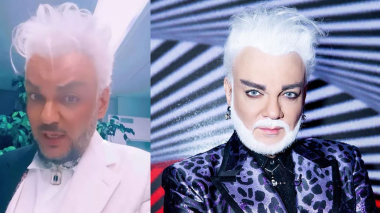 Կիրկորովը սենսացիոն կերպարանափոխություն է անելու. կրկին դիմել է վիրահատության