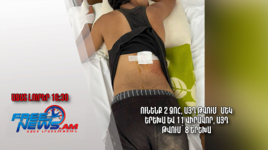 Ունենք 2 զոհ, այդ թվում՝ մեկ երեխա և 11 վիրավոր, այդ թվում՝ 8 երեխա․Ազատ լուրեր․19.09.23/16.30/