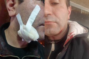 Ստեփանավանի քաղաքապետարան ներխուժած անձը հայտնի շառ անող է, նախկինում 4 անգամ դատապարտվել է. ԶԼՄ