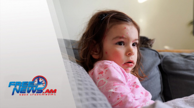 ՀՀ-ում կկիրառվի ջրծաղիկի դեմ պատվաստանյութը