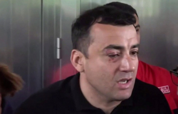 Ձերբակալված Արթուր Չախոյանն ազատ է արձակվել, կմնա հոսպիտալացված