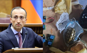 Մարտական նռնակը ոչ մի կերպ օրինական չի կարող համարվել․ Թորոսյան