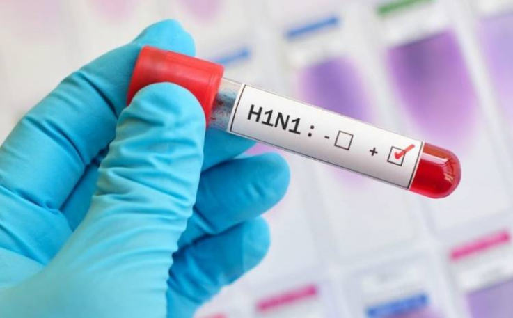 Հայաստանում H1N1-ից 2 մարդ է մահացել