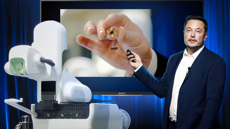 Neuralink-ով չիպավորված պացիենտը մտքի ուժով կարողանում է մկնիկը տեղաշարժել